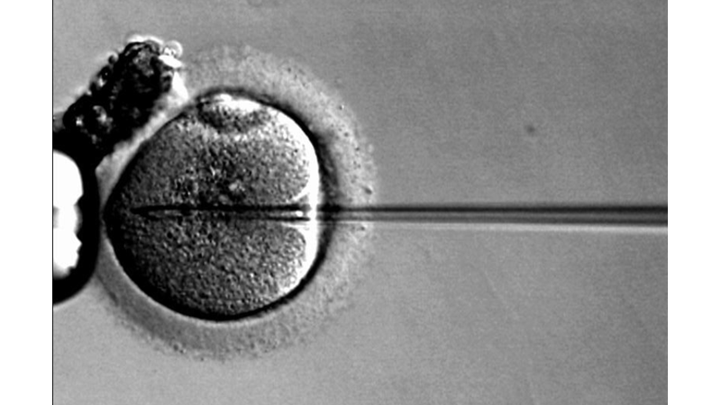 DÜNYANIN İLK ‘TÜP BEBEĞİ’NİN DOĞUM GÜNÜ KUTLU OLSUN!