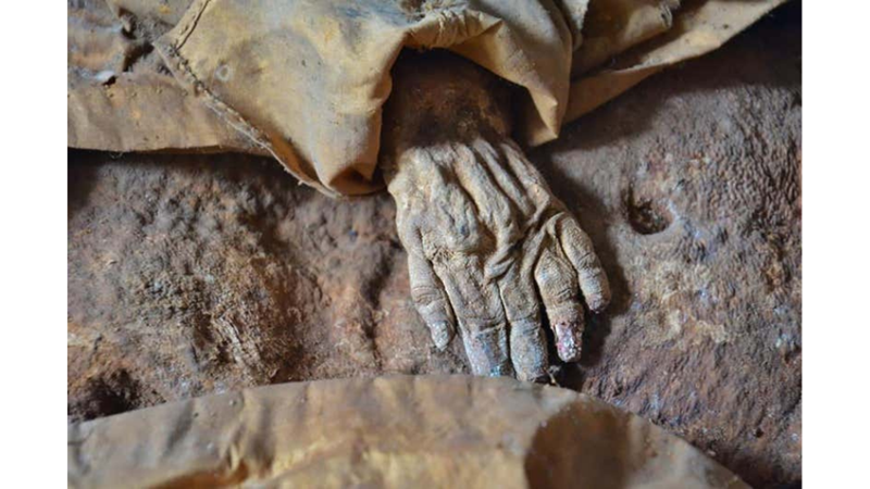 GÜNEŞ EKSİKLİĞİNİN BÖYLE ETKİSİ OLABİLECEĞİNİ BİLEMEZDİNİZ!