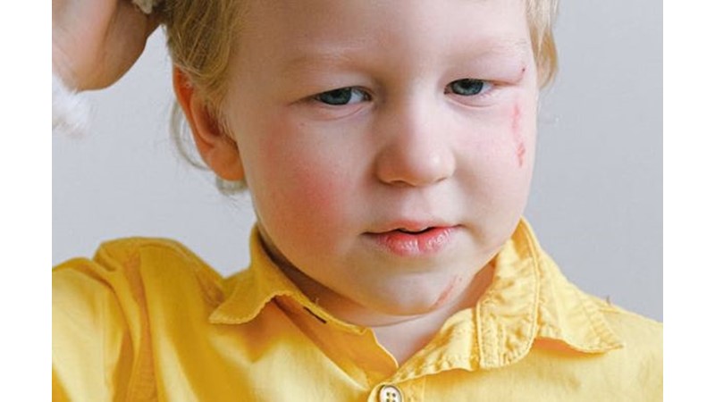 Anlaşılamayan Durumlar